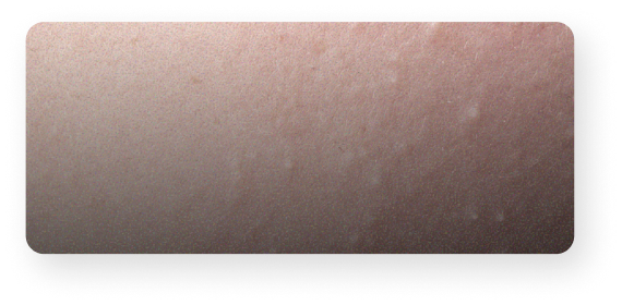 Grains de milium